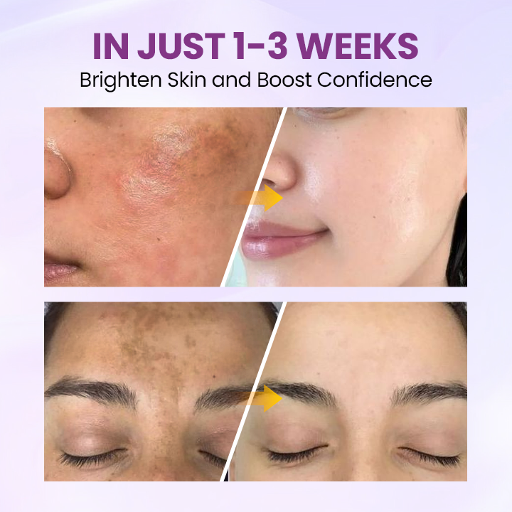 Glowrizon®RadiantClear Blemish & Brightening Serum