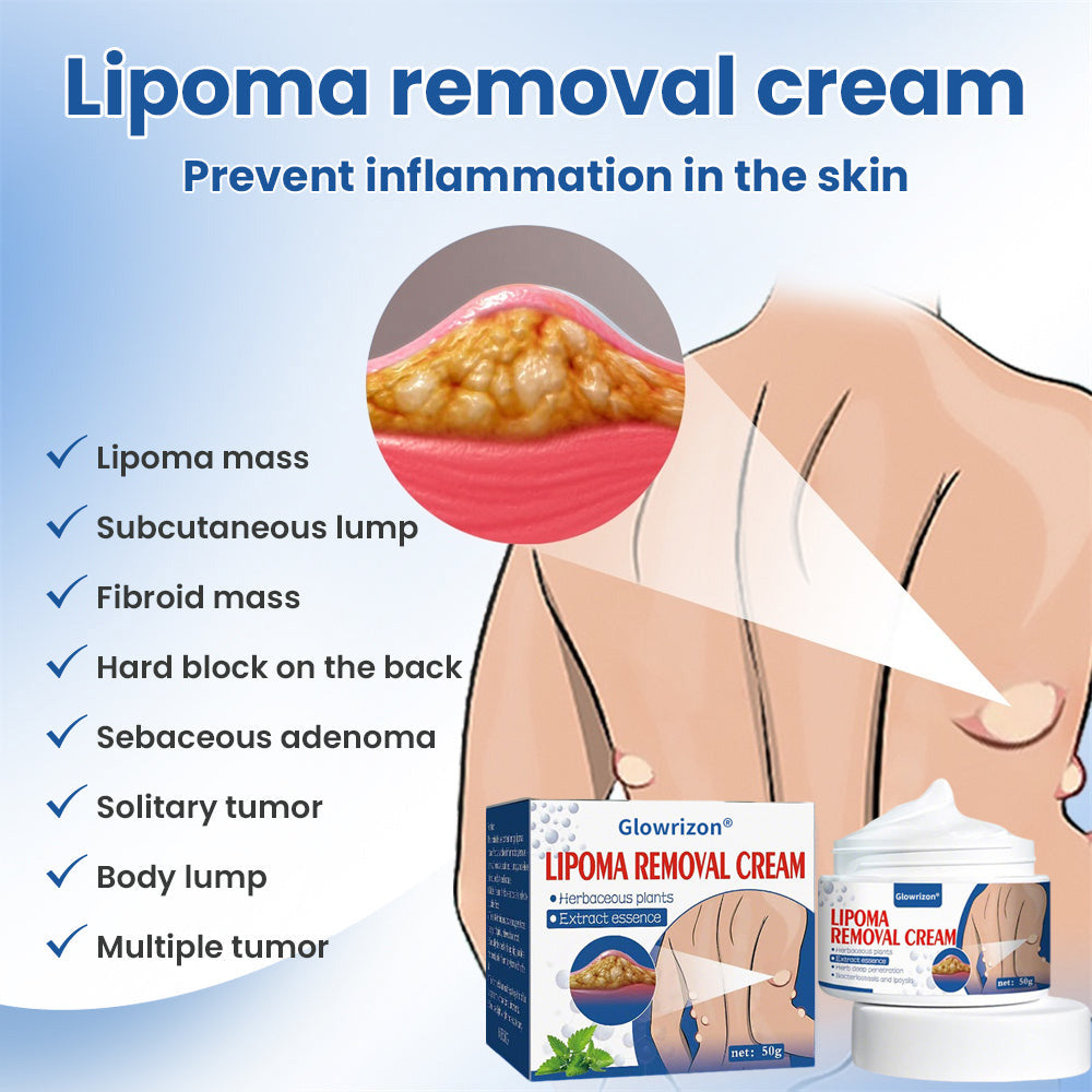 ⏰Last Day Promotion: 70% OFF🔥 Glowrizon® Lipoma Removal Cream