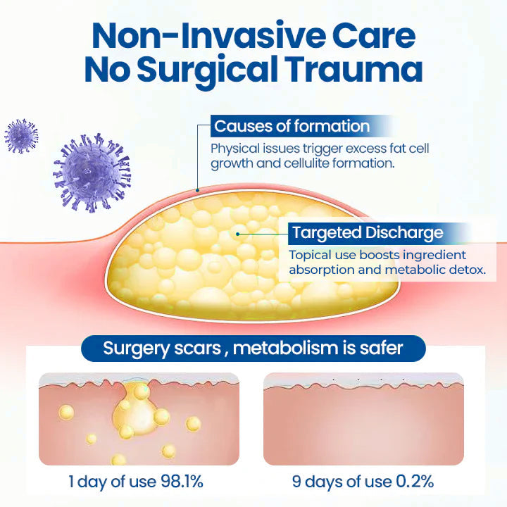 ⏰Last Day Promotion: 70% OFF🔥 Glowrizon® Lipoma Removal Cream