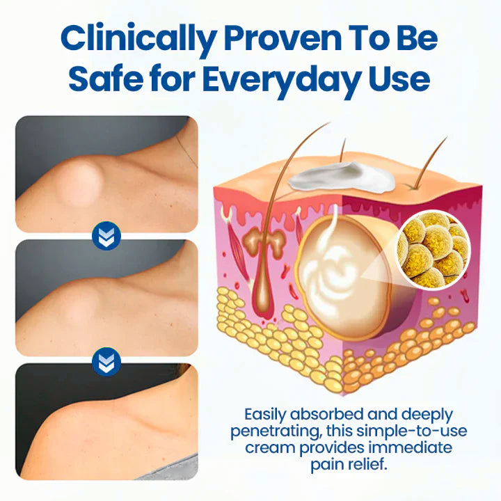 ⏰Last Day Promotion: 70% OFF🔥 Glowrizon® Lipoma Removal Cream