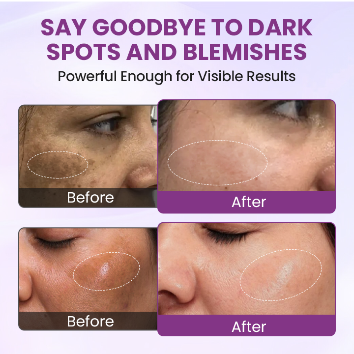 Glowrizon®RadiantClear Blemish & Brightening Serum