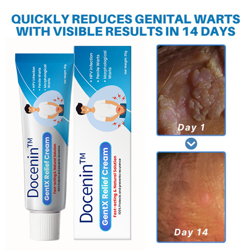 Docenin™ HPV Genital Warts Relief Cream
