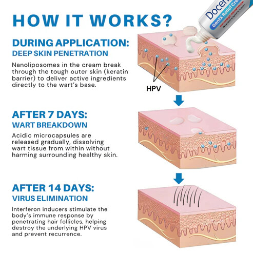 Docenin™ HPV Genital Warts Relief Cream