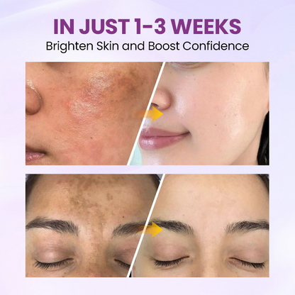 Glowrizon®RadiantClear Blemish & Brightening Serum