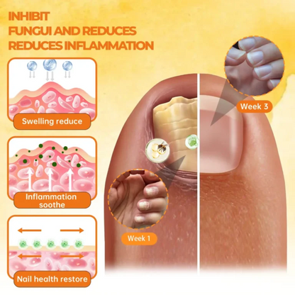 Cvreoz® Bee Venom Nail Renewal Spray - LIMITED-TIME OFFER | Bring out your best self-confidence!💕