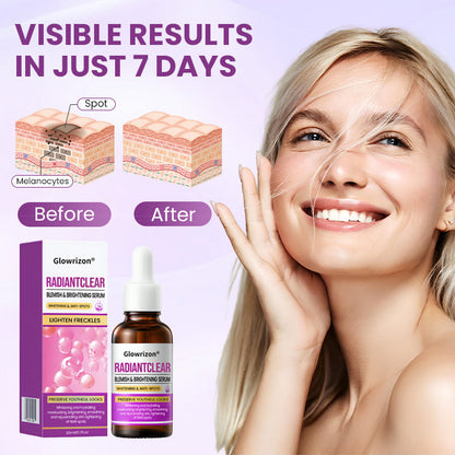 Glowrizon®RadiantClear Blemish & Brightening Serum