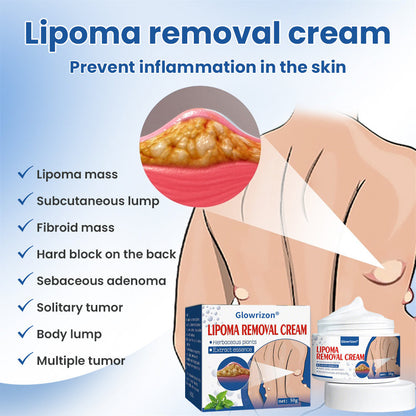 ⏰Last Day Promotion: 70% OFF🔥 Glowrizon® Lipoma Removal Cream