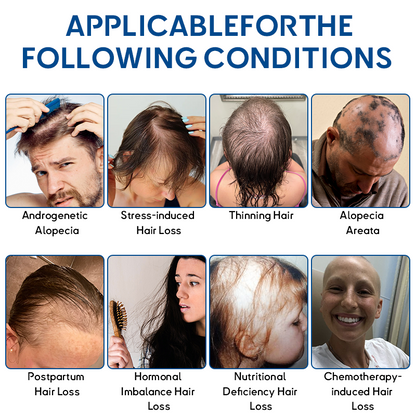 🍁𝐎𝐟𝐟𝐢𝐜𝐢𝐚𝐥 𝐒𝐭𝐨𝐫𝐞 | Flysmus® STEM Cell Hair Cycle Roller - Notice visible results in 7 days (🔥LAST DAY 70% OFF)