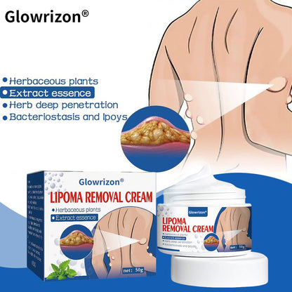 ⏰Last Day Promotion: 70% OFF🔥 Glowrizon® Lipoma Removal Cream