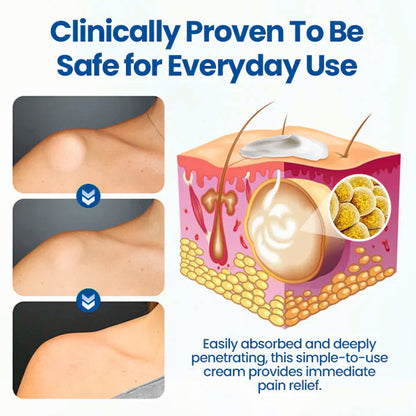 ⏰Last Day Promotion: 70% OFF🔥 Glowrizon® Lipoma Removal Cream