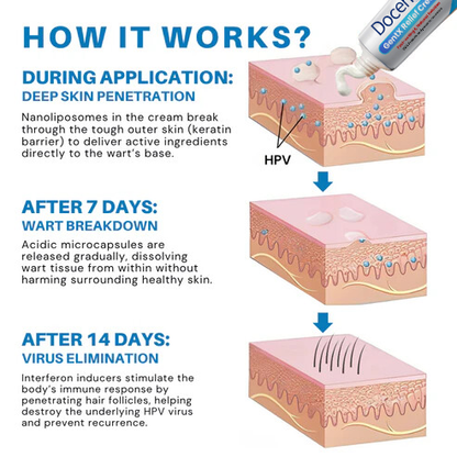 Docenin™ HPV Genital Warts Relief Cream